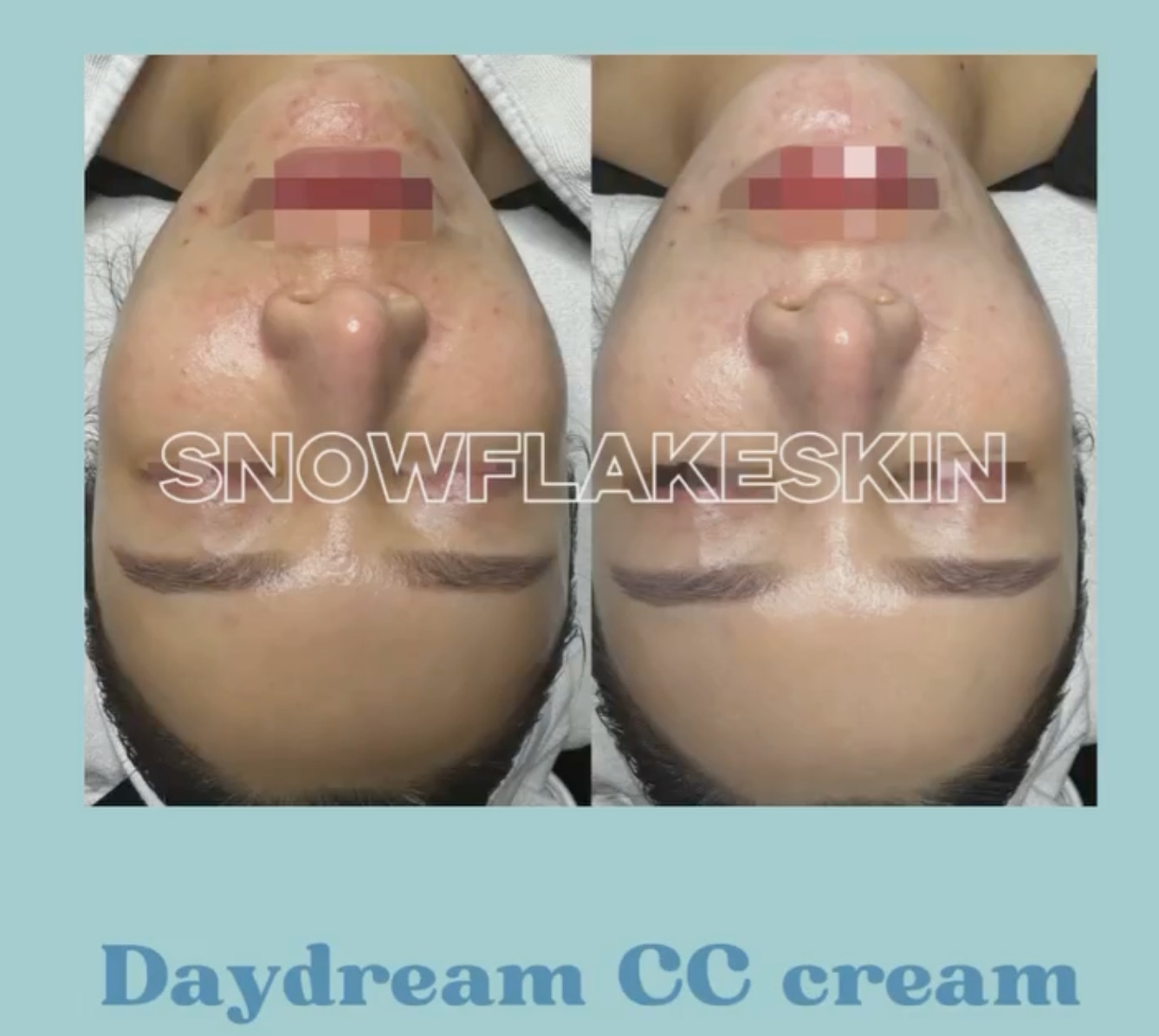 Snowflake Daydream CC