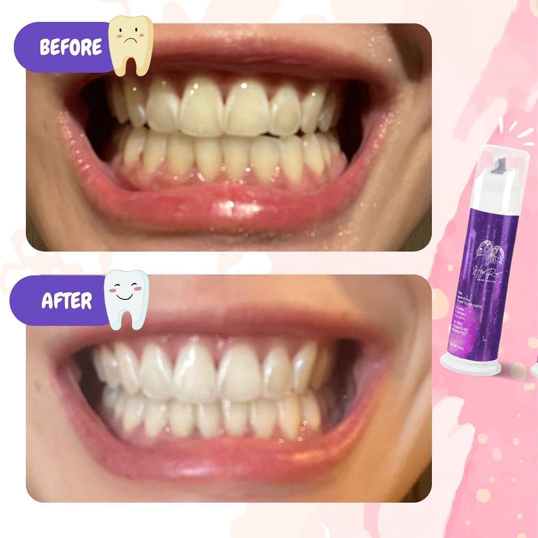 HeyRoxo Tone Neutralizing Purple Toothpaste